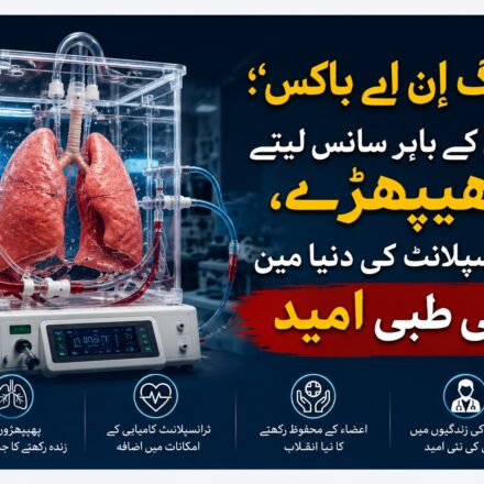 لنگ اِن اے باکس